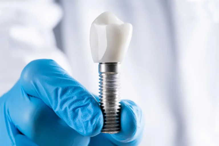 Victoria Clinic Implantologia Uslugi stomatologiczne